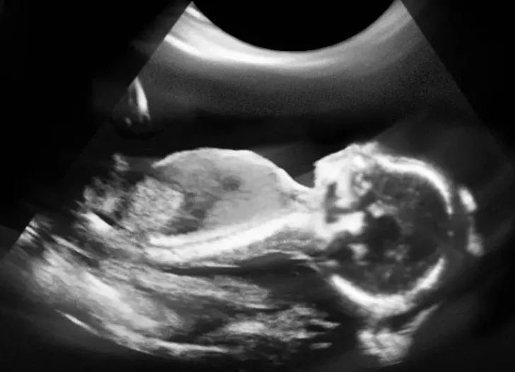 健康一点通怎么查看体检报告,健康孕检单视频