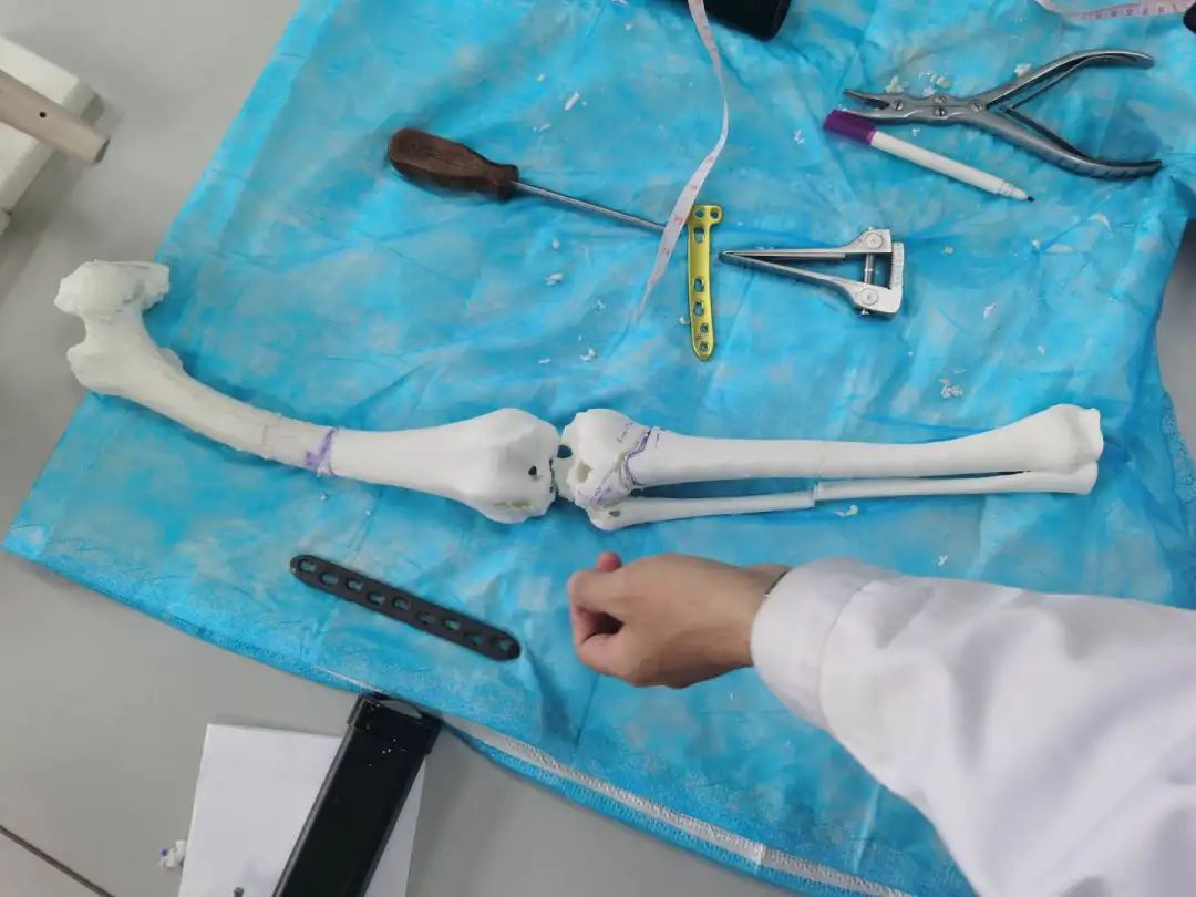 截骨手术是什么手术全过程,截骨矫形手术全过程