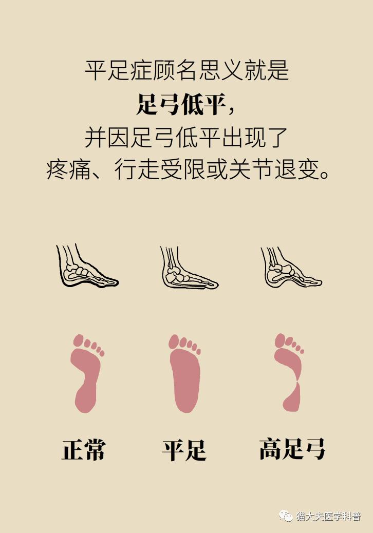 走几百米就痛得不行，这样的平脚板怎么治？