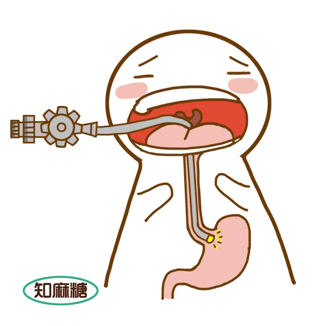 胃肠镜能睡着做，就别醒着了