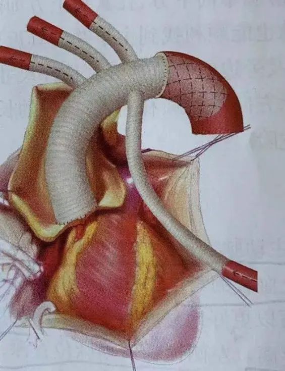 世界心脏日视频,世界心脏日是什么意思