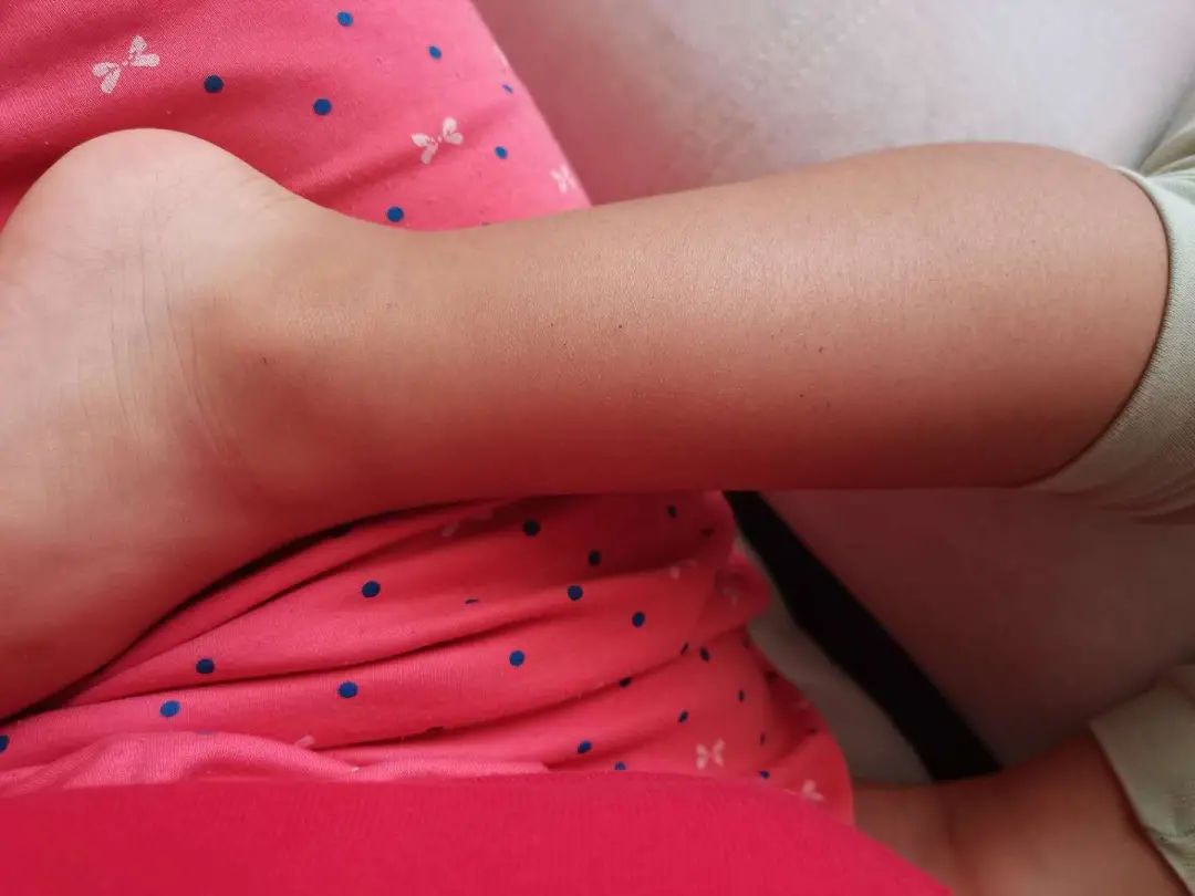 幼儿园针扎8名儿童,幼儿园儿童被针扎