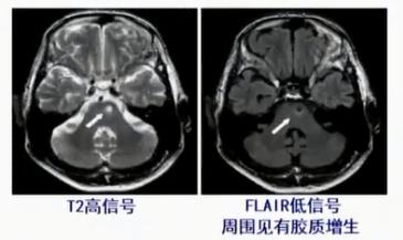 徐运神经内科,徐运医生怎么样