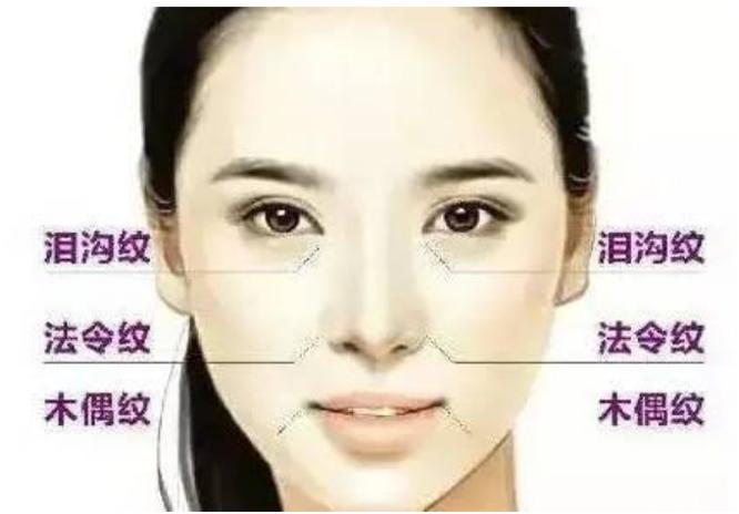 脸上有了皱纹抗老,抗皱要趁早等皱纹出来就晚了