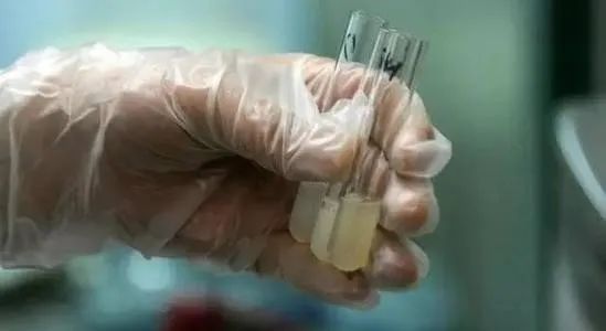 全球男性精子危机,日本男性精子质量