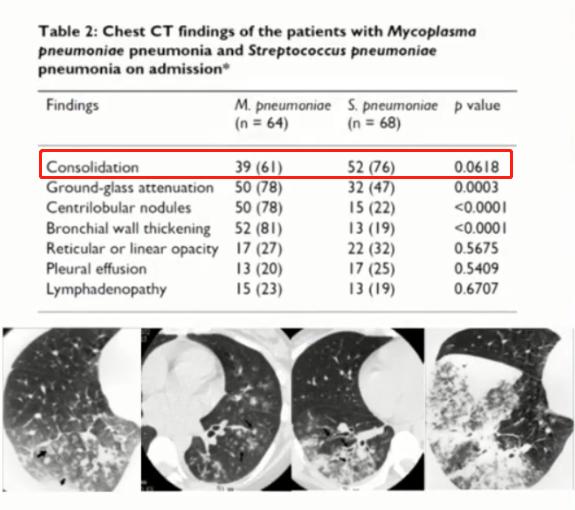 支原体肺炎症状中医诊治,成人肺炎支原体肺炎诊治专家共识