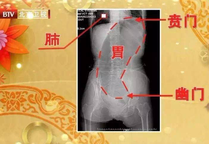 消化不好大家都是怎么治好的,消化不好的5大征兆