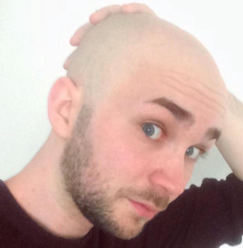 没有头发的人是不是很傻,没有头发的人生活怎么样