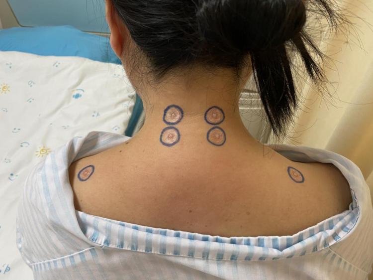 骨伤科的守正创新,传统与现代康复手法治疗颈椎病