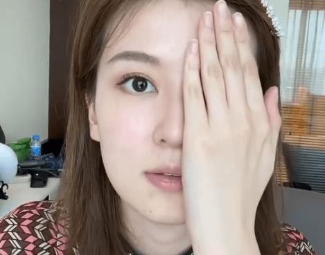 眼综合包含在眼综合吗,眼综合每个人都适合吗