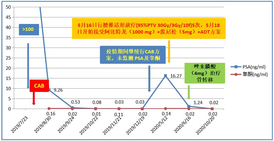 疫情期间进展为mCRPC阶段高危患者，醋酸阿比特龙可迅速控制病情|经典病例