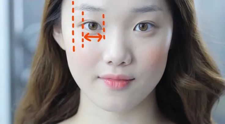 眼综合包含在眼综合吗,眼综合每个人都适合吗