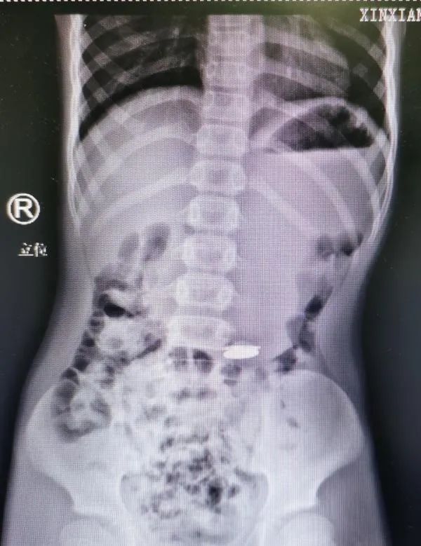 中印边境对峙事件完整过程回顾,央视报道中印对峙完整视频
