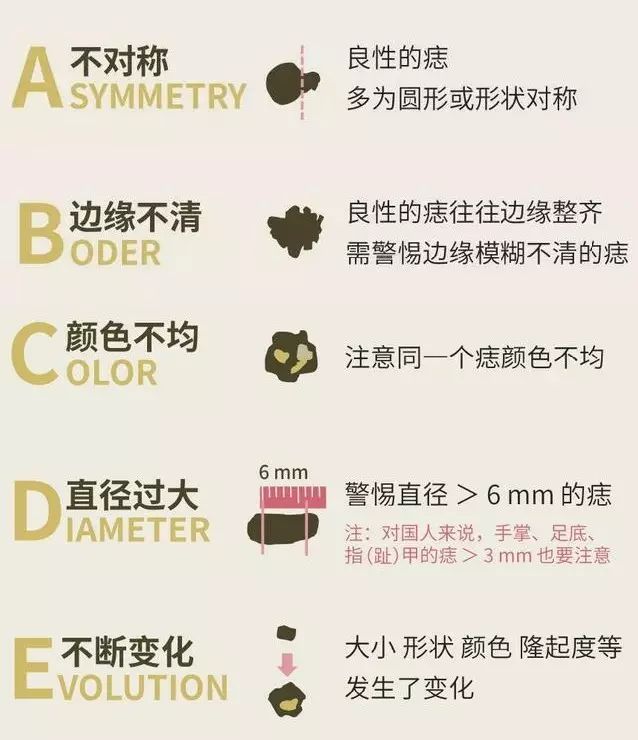 头皮上的黑痣要不要紧,头皮好多小色素痣怎么办