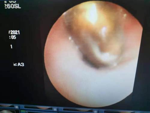 3岁孩子突然晚上睡觉打呼噜,3岁男宝宝睡觉打呼噜什么原因