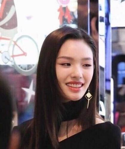 明星做烤瓷牙变凸嘴,明星烤瓷牙凸嘴