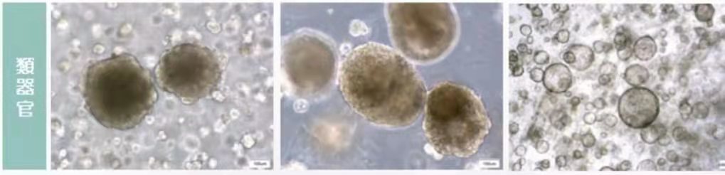 “复制”癌变器官帮患者试药?这种测试已在香港推出