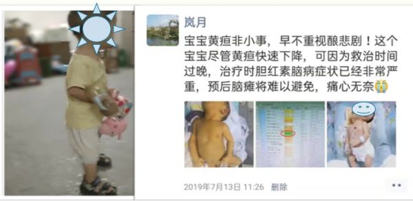 刚出生的宝宝黄疸怎么预防,新生宝宝为什么容易出现黄疸