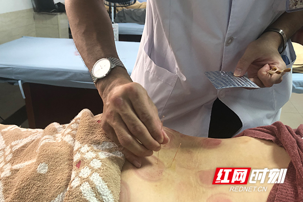 有温度的养生理疗,有针灸推拿专业的学院