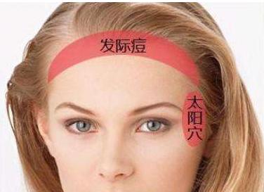 额头长痘一直不好要去医院吗,左右脸颊长痘是肝不好还是脾不好