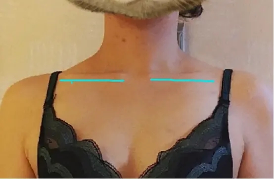 斜方肌太大怎么练视频,斜方肌太大了怎么练哑铃