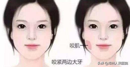 该怎么拯救瘦长脸,如何拯救抬头纹