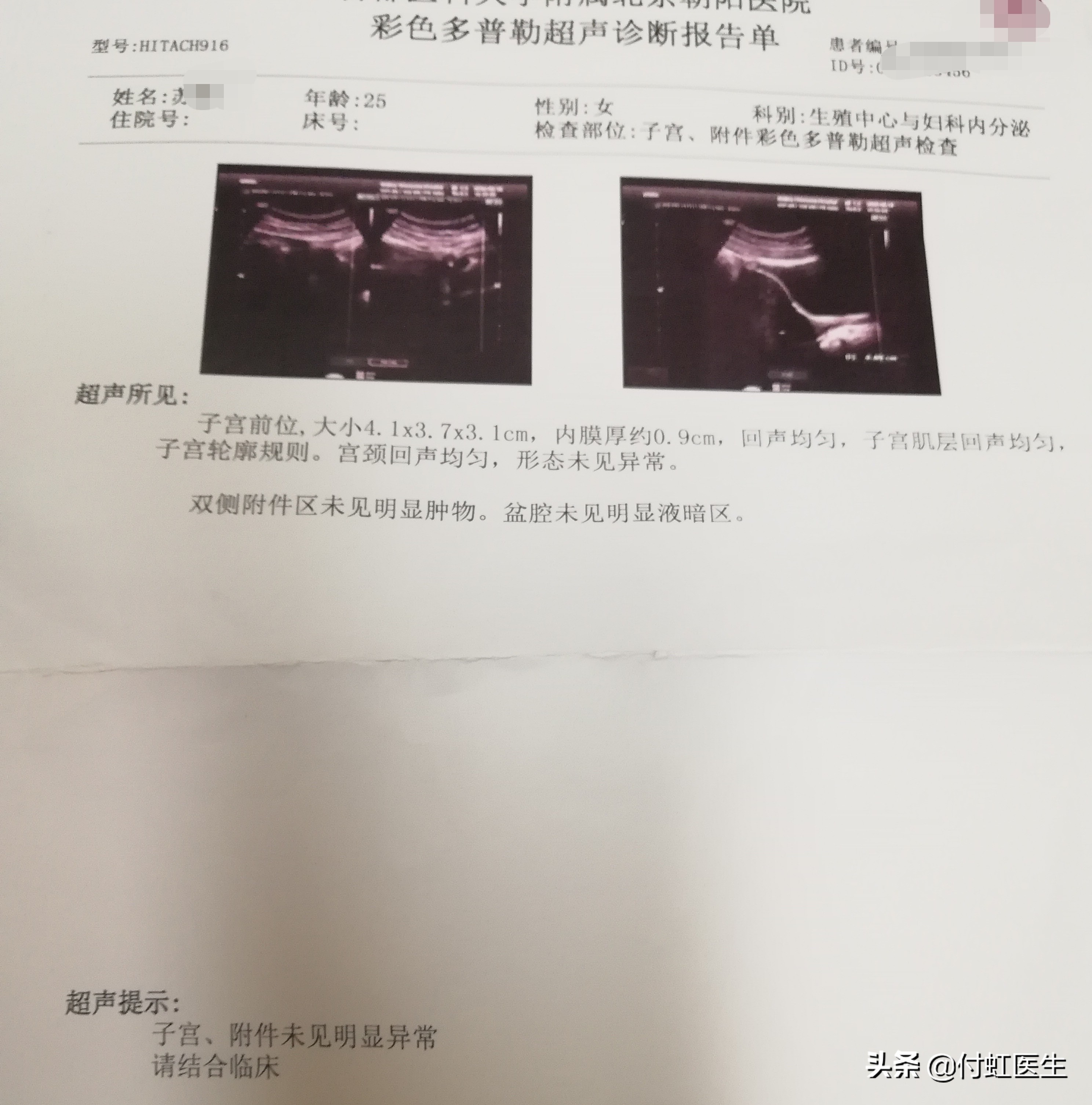 25岁50天没来月经但没怀孕,25岁停经两周了