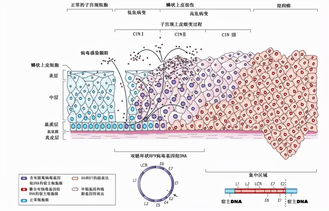 2价hpv疫苗和2价hpv吸附疫苗区别,hpv疫苗深度解析