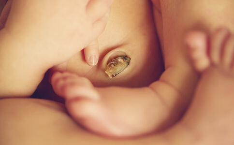 新生儿脐带很脆弱:出血、流水、发炎、发红、不脱落如何护理?