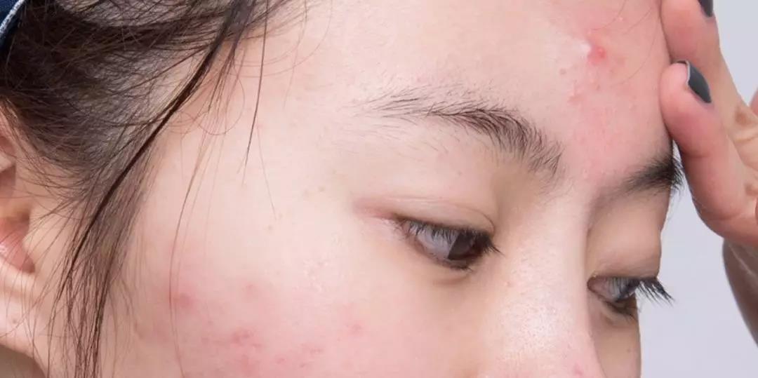 适合夏天油皮痘肌的水乳测评,fresh水乳适合敏感肌油皮