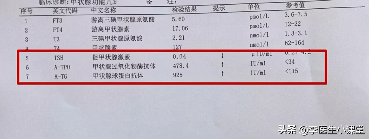 桥本氏甲状腺炎会引发ca125升高吗,桥本氏甲状腺炎能自愈或治愈吗