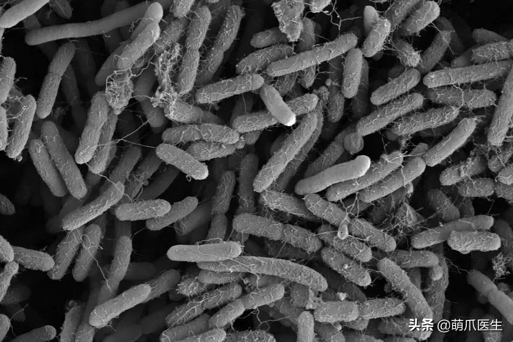 猫咪喝水碗里有红色蠕动虫子,猫咪喝水碗里有小黑虫