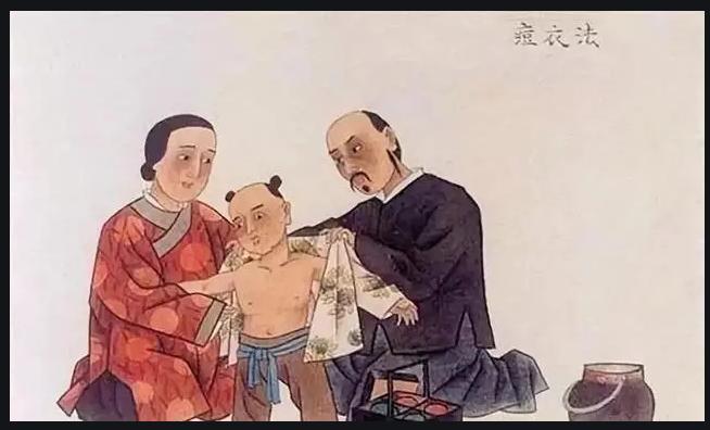 康熙宫女实验,康熙治天花的小故事
