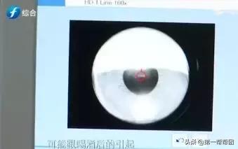 福州男子喝酒胃里全是血,福州一男子倒地吐血