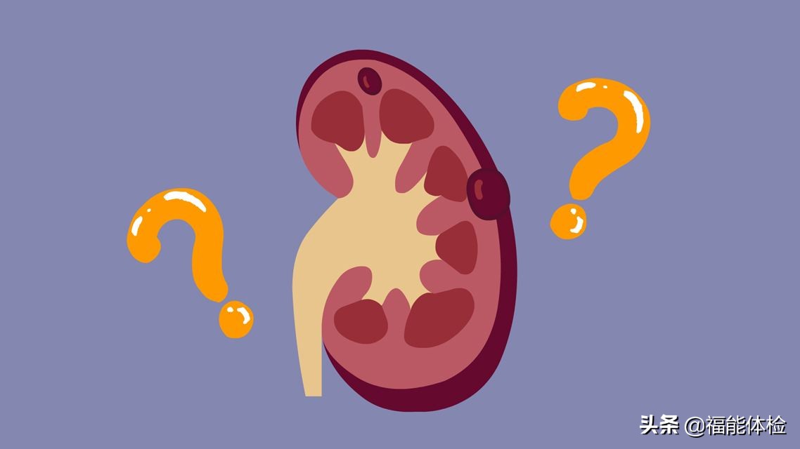 体检有肾囊肿需要注意什么,体检发现肾囊肿要怎么办