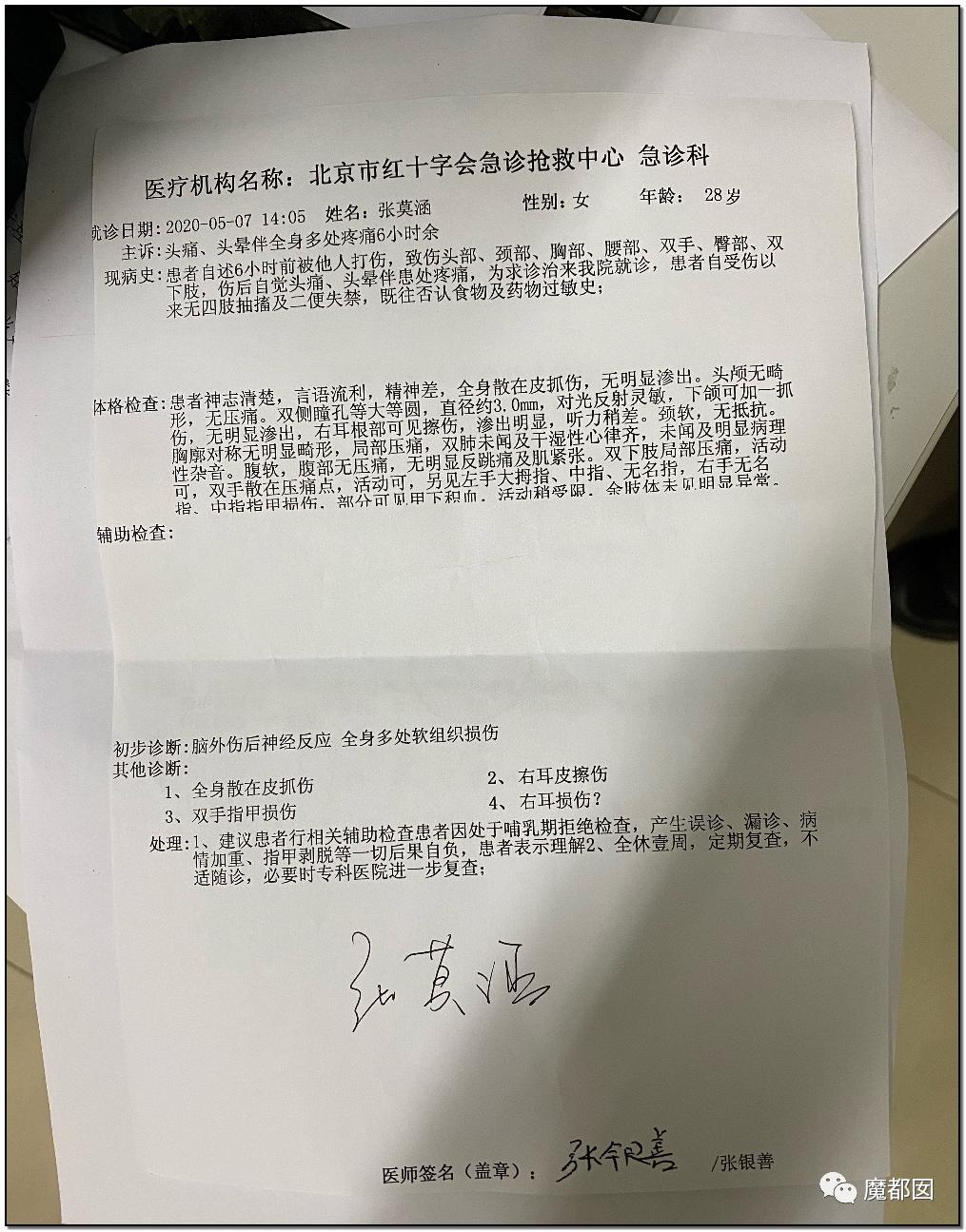 短跑名将张培萌家暴事件,短跑名将张培萌被控家暴