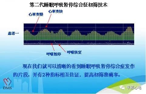 打鼾动手术有什么危害,肥胖打鼾的人有什么危害