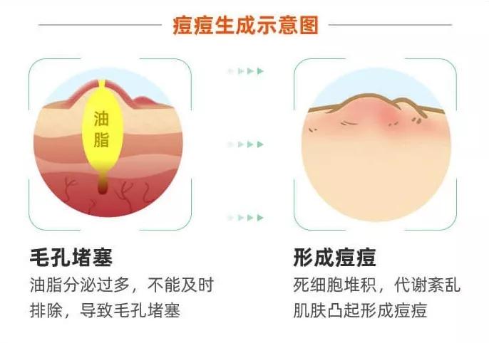 如何轻断食祛痘,酵素祛痘用法