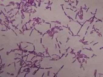 蓝藻爆发最佳治疗方法,蓝藻的最佳防治方法