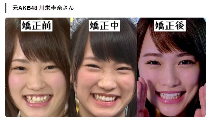 牙齿不整齐的日本女孩,日本人牙齿不齐怎么回事