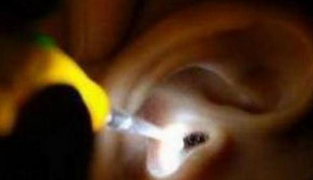 孙女耳朵里意外进飞蛾，奶奶教科书式救助，医生知道后都连连称赞