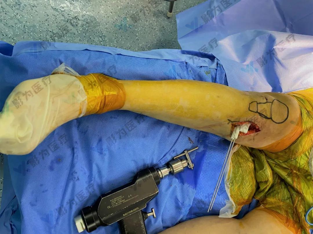 安医大阜阳附属医院减重,阜阳市颍州区安医大附属阜阳医院