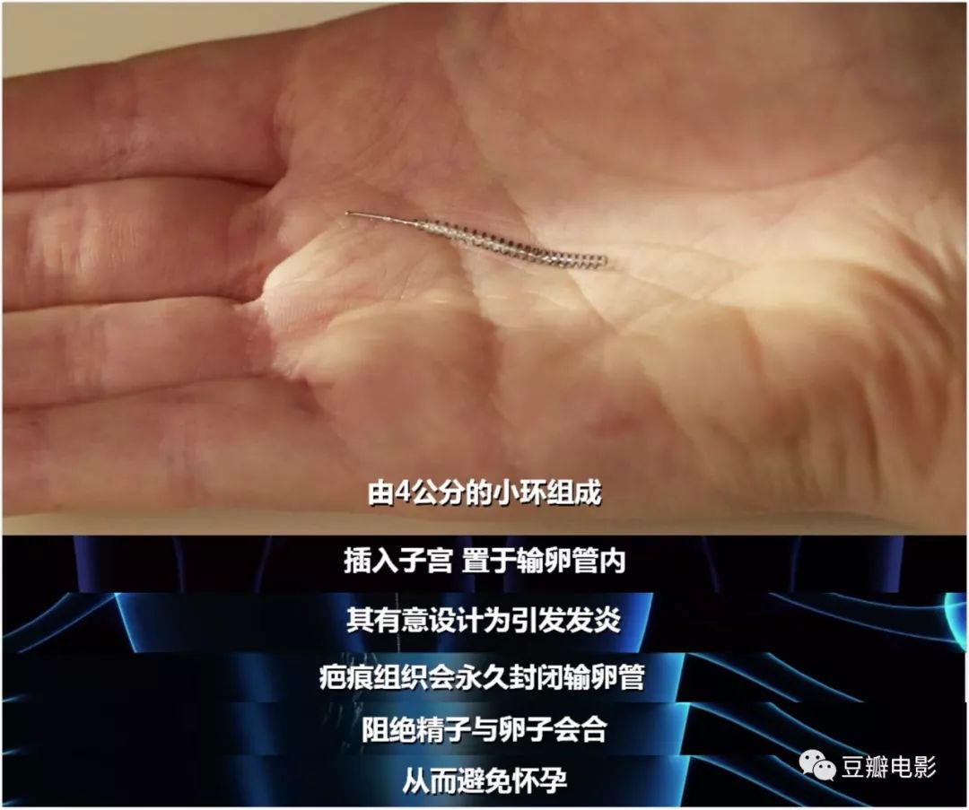 豆瓣9.0，揭露医疗*局骗**，这片太血淋淋