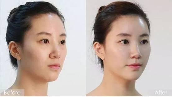 美白抗皱国货之光,提亮美白补水国货之光