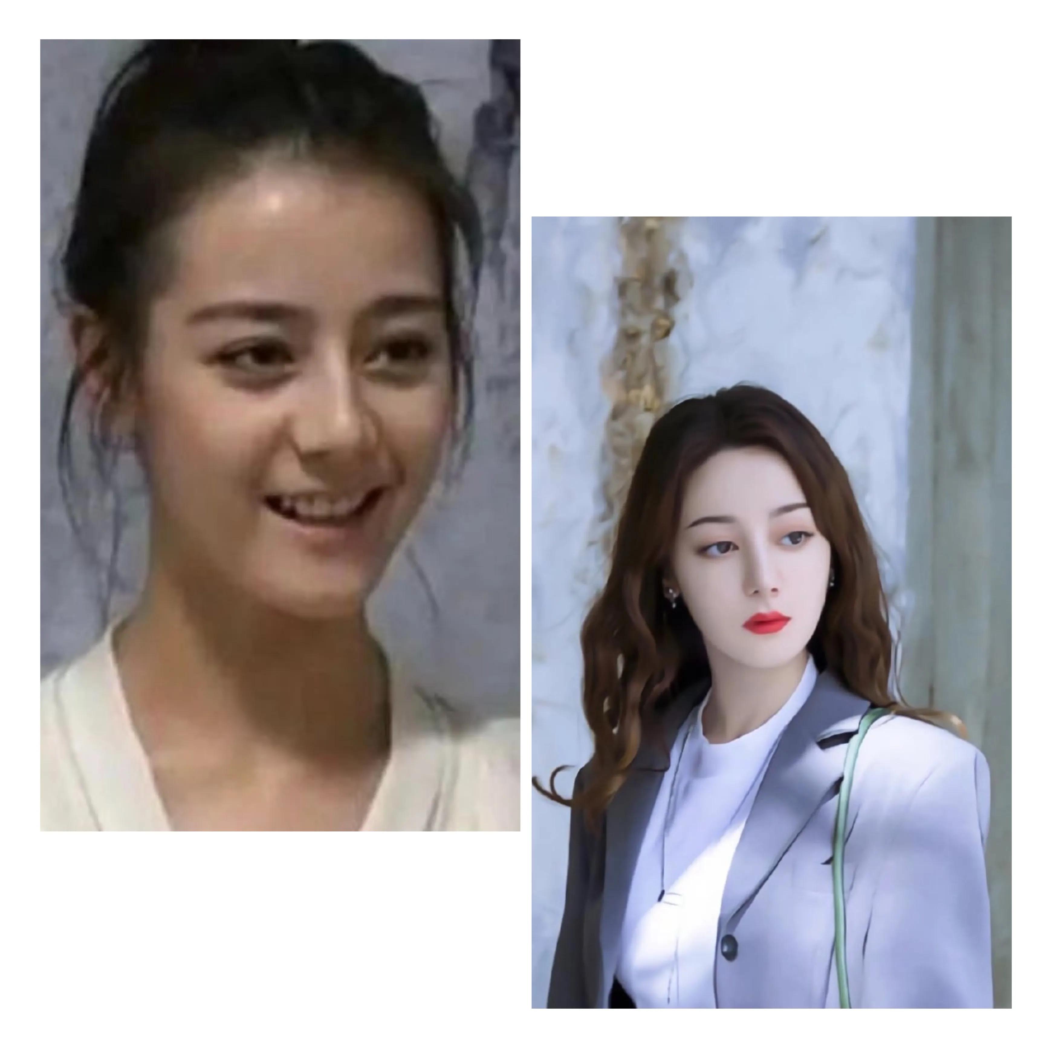 最有效果的美白精华液,效果最好的美白精华液