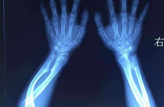 如何学习骨科康复治疗,骨科科普宣教小知识