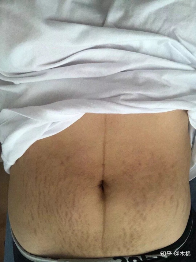 汤唯什么时候能生孩子,汤唯被爆个人隐私