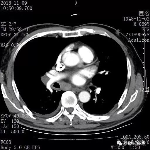 怎么应用统计学做调查,统计学方法可以解决的主要问题