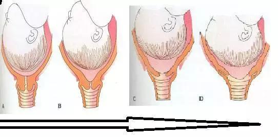 张宏玉教授呼吁:除非有紧急医学情况,否则不要提前选择剖宫产!