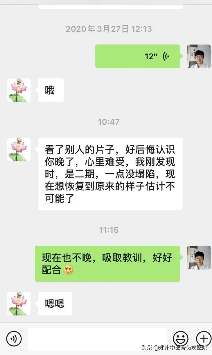 双侧股骨头坏死治愈后,骨坏死半年